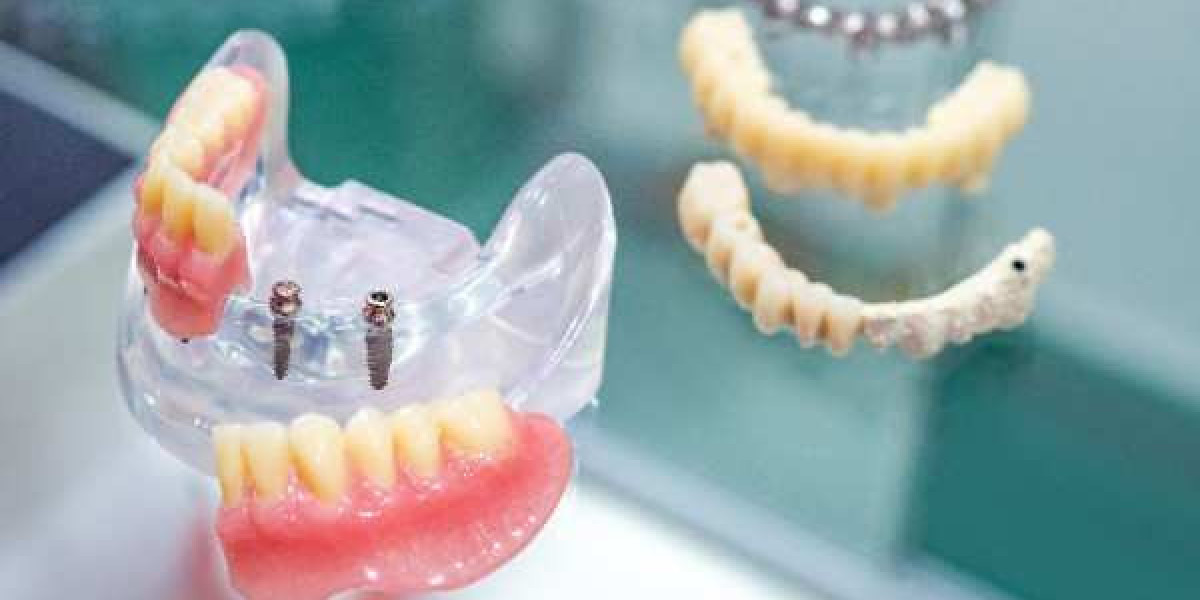 Everyday Solutions That Keep You Smiling in Blackburn